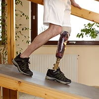 Scarring-Disfigurement-attorney